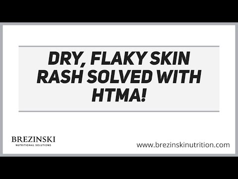Mysterious Dry, Flaky Skin Rash Solved with Hair Tissue Mineral Analysis (HTMA)